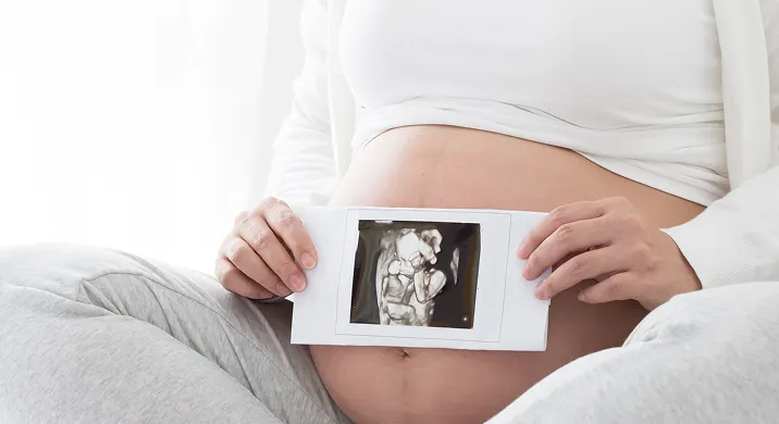 A pregnant woman sitting down and holding an ultrasound photo representing Obstetric Services.